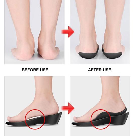 Insoles for Flat Feet -orthotics for Flat Feet -  Arch Support , Shoe Inserts
